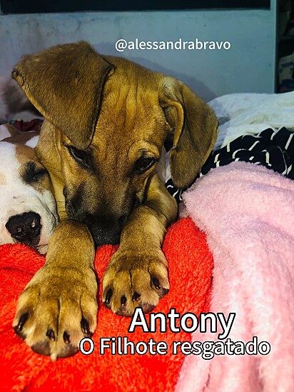 Antony está lutando por sua vida.