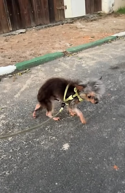 Dificuldades de coordenação são alguns dos sintomas da hidrocefalia. 