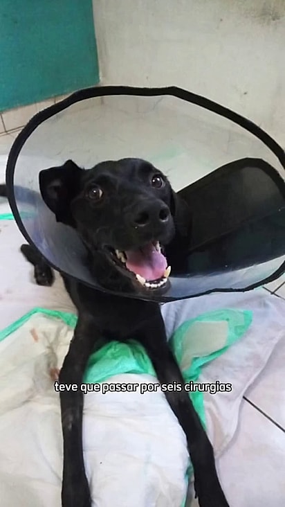 Lençol passou por 6 cirurgias e continua sorrindo.